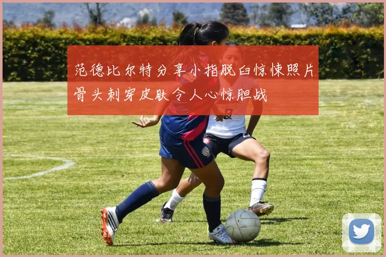 范德比尔特分享小指脱臼惊悚照片骨头刺穿皮肤令人心惊胆战